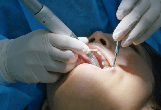 Oral Maxillofacial Case Study